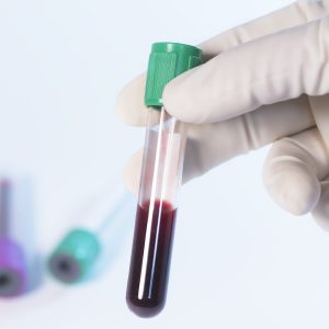 Close up of hand of laboratory technician holding test tube with blood sample with another test tubes in backside on white background.